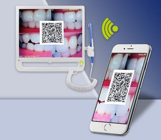 Monitor Dental Avanzado de 17" con Cámara Intraoral HD y Conexión WiFi