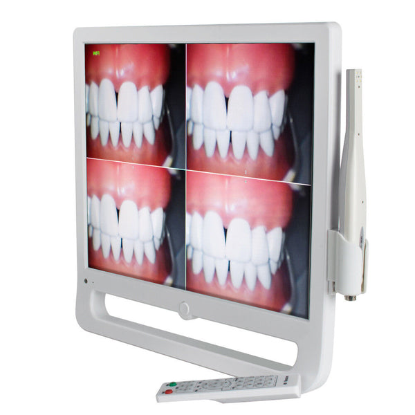 Monitor Dental Avanzado de 17" con Cámara Intraoral HD y Conexión WiFi