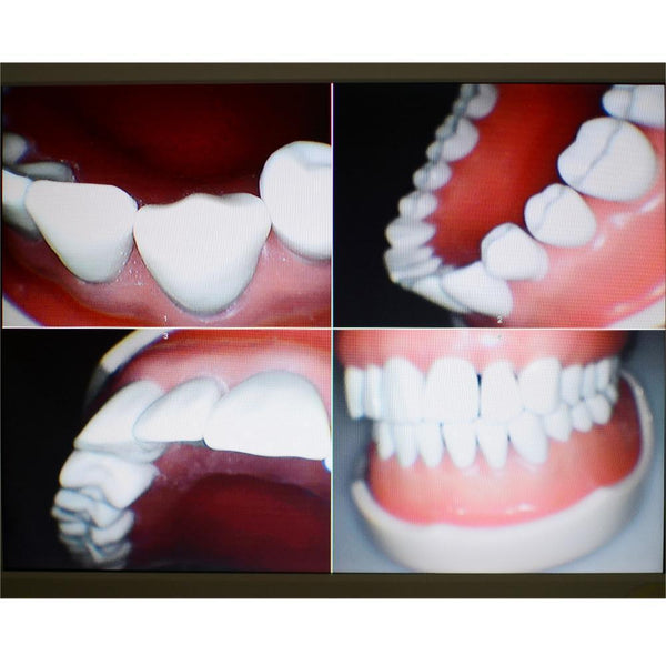 Monitor Dental Avanzado de 17" con Cámara Intraoral HD y Conexión WiFi