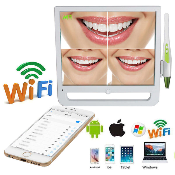 Monitor Dental Avanzado de 17" con Cámara Intraoral HD y Conexión WiFi