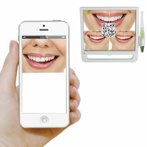 Monitor Dental Avanzado de 17" con Cámara Intraoral HD y Conexión WiFi